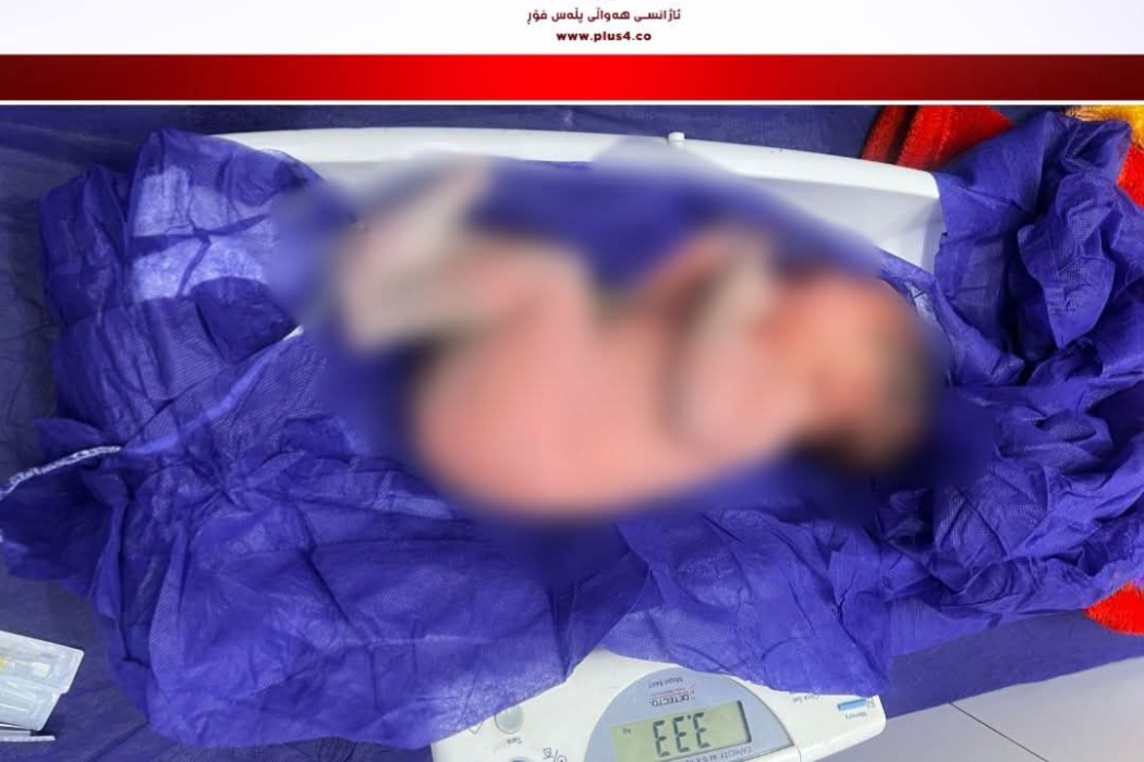 دۆزینەوەی منداڵێک